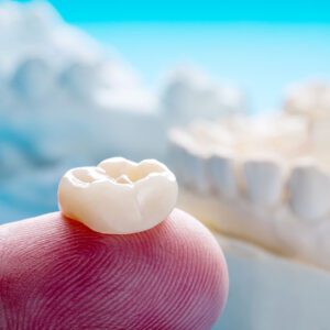 family dentist near me dental crowns