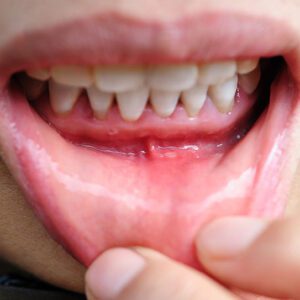 Jackson Family Dentistry | Downers Grove Dentist -